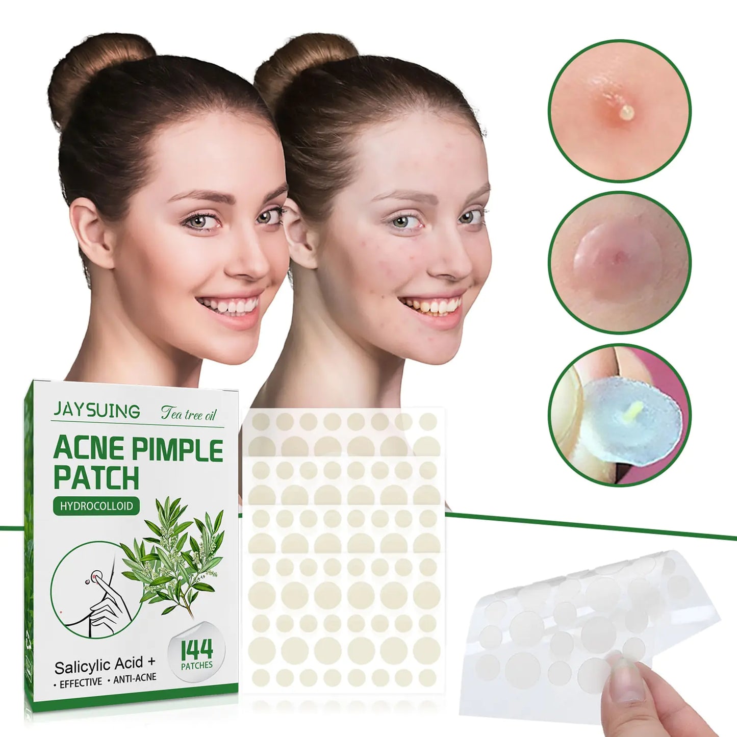 Blemish Busters: Acne Patches