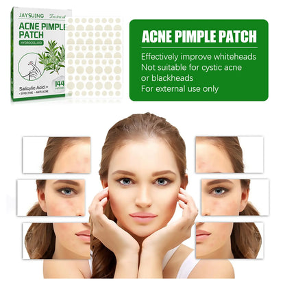 Blemish Busters: Acne Patches