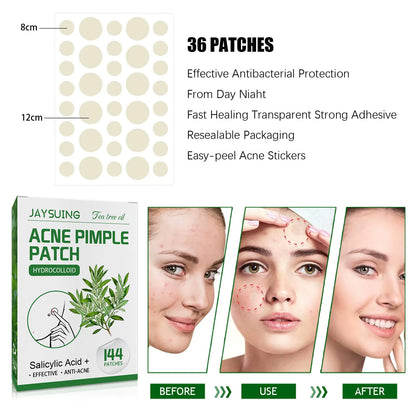 Blemish Busters: Acne Patches